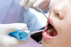 洗牙后，牙齿会健康吗？洗掉的东西是什么？或许多数人还蒙在鼓里图片