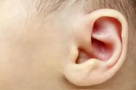 孩子耳朵上有个小洞就是“富贵命”？其实是先天性外耳疾病图片