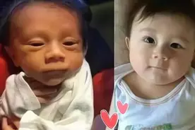 新生儿为什么会“丑”？6种生理现象造成的，做到6点，宝宝更健康图片