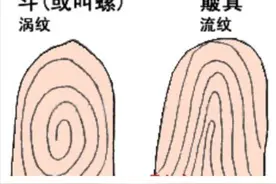 箕代贫、斗寓富、断掌的智慧高？中科院最新研究揭开指纹基因奥秘图片