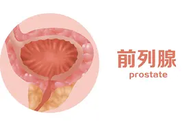 男人的哪些习惯，会让前列腺很受伤？能不做尽量不做图片