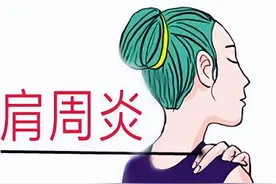 肩周炎该如何进行功能锻炼？图片