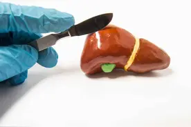 肝脏癌变不是突然发生的，身体4种“异常”是肝脏的“求救声”图片