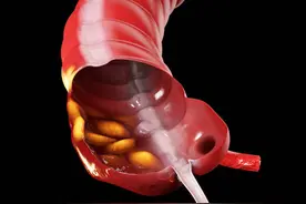 提醒：肠镜能查出早期肠癌，有这8种情况的人，最好每年检查一次图片