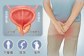 前列腺是男人的生命腺，提醒：4个症状出现，或是前列腺增生信号图片