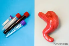 胃功能检测是怎么回事？哪些人需要做？图片