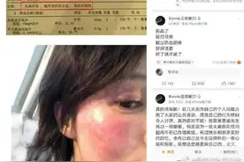 娱乐圈又出下头男？黄景瑜婚内不忠家暴？图片