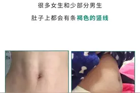 为什么很多女生肚子上，有条褐色的竖线？看完这个你就知道了图片