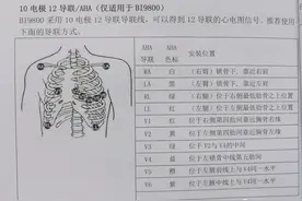 动态心电图导联位置、心电图测量方法图片