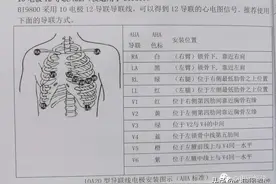 动态心电图导联位置、心电图测量方法图片