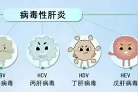 这些症状不一定是皮肤病，可能是肝有问题了图片