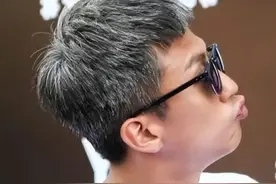 为什么越来越多的年轻人长白头发？如果是这几个原因，一定要重视图片