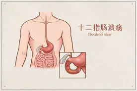 这个疾病早期症状跟胃炎很像，好发于青中年人群图片
