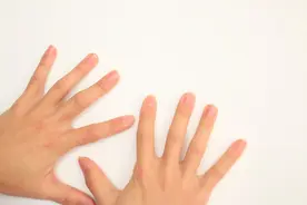 为什么有些人手上的青筋很明显？凸起的青筋，是好是坏？公布答案图片