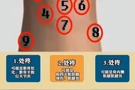 膝盖疼痛对照表！快来看看你的疼有解吗？图片
