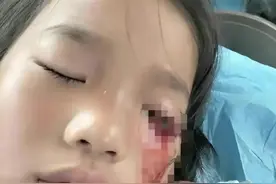 后续！江苏8岁女童眼睛被男孩打瞎：有免罪金牌不立案，内幕透露图片
