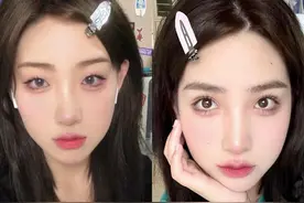 割得双眼皮和天生的双眼皮，有什么区别？爱美女生要格外注意图片