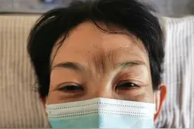 针灸治疗印堂发黑案例一则图片