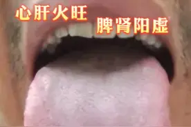 今日分享一舌诊案例：心肝火旺！脾肾阳虚！脾胃虚弱！肝血不足！图片