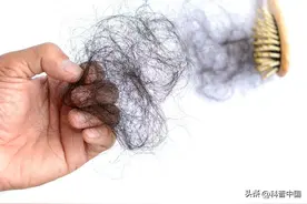 总是掉头发，是身体出问题了吗？1 招教你自查！图片