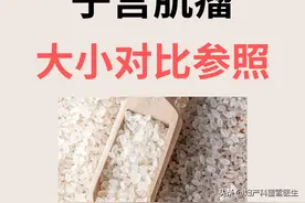 身体里住了个“鹅蛋”？子宫肌瘤真是不小啊。图片
