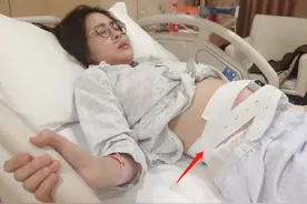 张碧晨“待产照”传出，33周早产孕肚不明显，好友对谣言很无奈图片