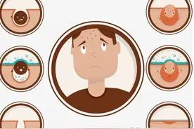 脸上有小块硬硬的东西不痛不痒怎么回事儿吃什么药图片