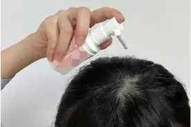 医学生真实记录使用5%米诺地尔，长头发真的太坎坷了！图片
