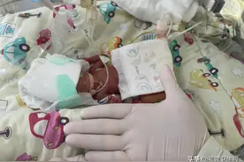 奇迹！福州双胞胎“巴掌宝宝”出生不足1斤，142天闯关成功！刷新记录图片