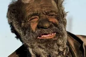 伊朗男子68年未洗澡，腐肉当食物，牛粪当烟抽，身体发生怎样变化图片