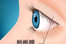 眼皮上长小疙瘩要注意什么？图片