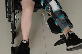 髌骨骨折术后21天，每天一次掰腿，感觉自己快坚持不下去了图片