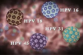 46岁大姐棋牌室感染HPV，“肉芽”长满脖子，劝告：四件事要少做图片
