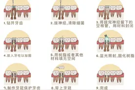 根管治疗后，需要做牙冠来保护牙齿图片