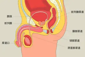 如何防止慢性前列腺炎“死灰复燃”？图片