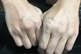 有的人手臂“青筋暴起”，有的人几乎看不到青筋，两者谁更健康？图片
