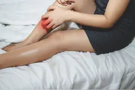 大腿根部长红斑，错把股癣当湿疹图片