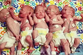 山东泰安首例，5胞胎降生，4男1女，请大力援助图片