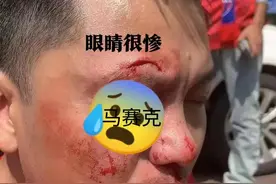 23日成都与重庆球迷发生流血冲突事件图片