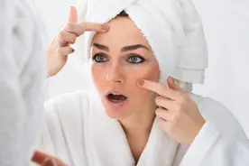 脸上长斑，是由于什么原因引起的？看看医生怎么说图片