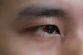 被骗缅北的00后被警方成功解救，“我以为我要死在那里了”图片