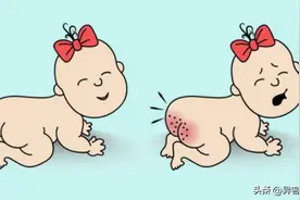 新手父母如何防治宝宝的尿布疹？图片
