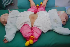 2009年湖北女子生下一对“连体婴儿”，十年之后她们怎么样了图片