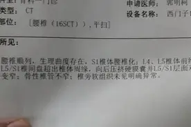 37岁急性腰椎间盘突出，到不能走路，我的抗突经历。图片