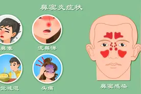 鼻子总堵？爱流鼻涕？中国鼻窦炎患者近2800万？鼻窦炎症状全解析图片