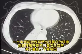咳咳咳！孩子咳个不停，到底是肺炎还是感冒，3招在家就能判断图片