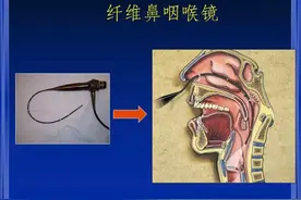 上了几节课就喉咙干痛？这种教师常见病要注意，喝金银花胖大海水也没用图片