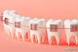 整牙后不再是大小脸 牙齿矫正真的能变美吗？图片