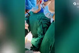 正颌术后有哪些并发症？图片