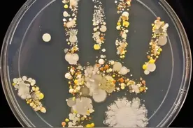 孩子总爱揉眼睛不一定是犯困，也可能是眼睛出现了这3种问题图片
